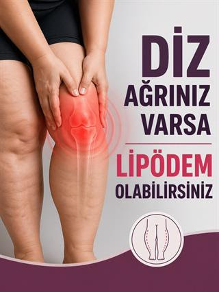 Nedeni Bilinmeyen Diz Ağrılarının Altından Lipödem Çıkabilir